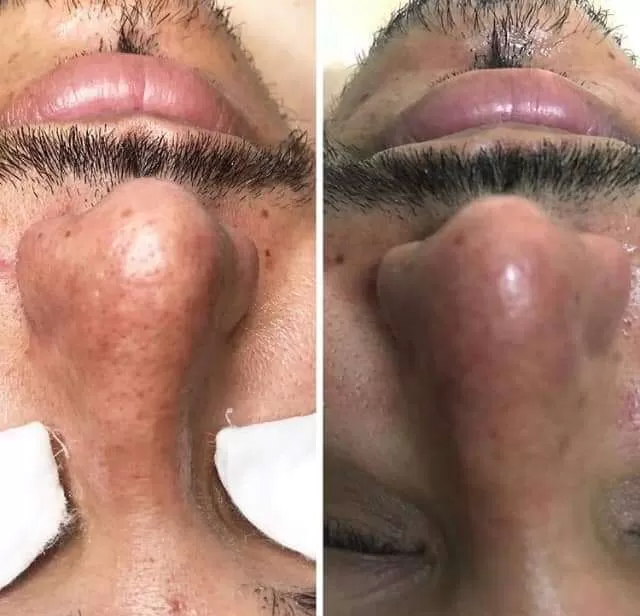 Galería de Cabina Depila T Cosmetologa Karina Garcia
