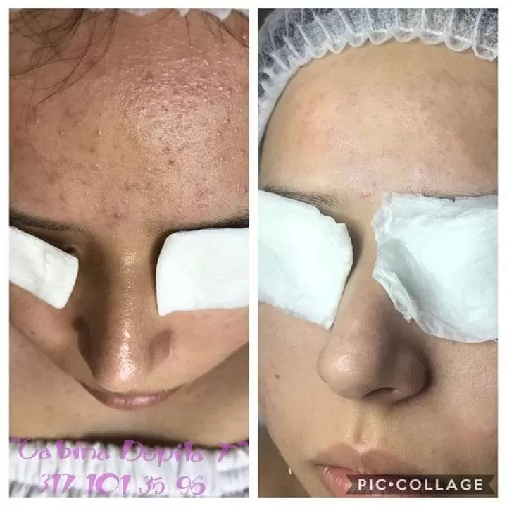 Galería de Cabina Depila T Cosmetologa Karina Garcia