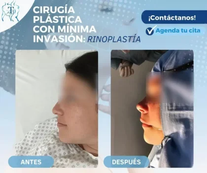 DR. TOMÁS IBARRA HURTADO - foto 5