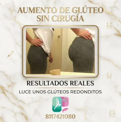  — MEDIC ESTHETIC en MONTERREY