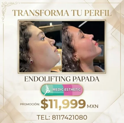  — MEDIC ESTHETIC en MONTERREY