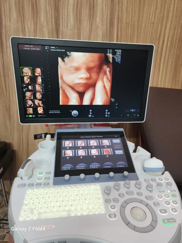 UNIDAD DE DIAGNOSTICO FETAL